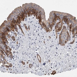 BCAM/CD239 Antibody, Novus Biologicals 25 &mu;L, Unlabeled:Antibodies,